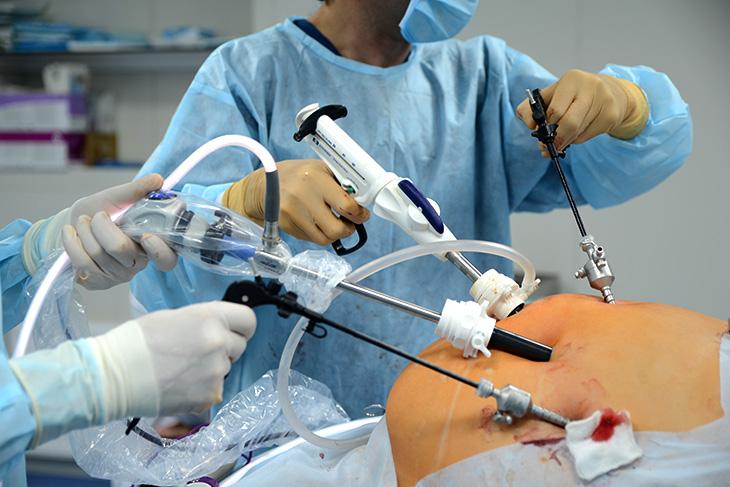 Хирургия ксм