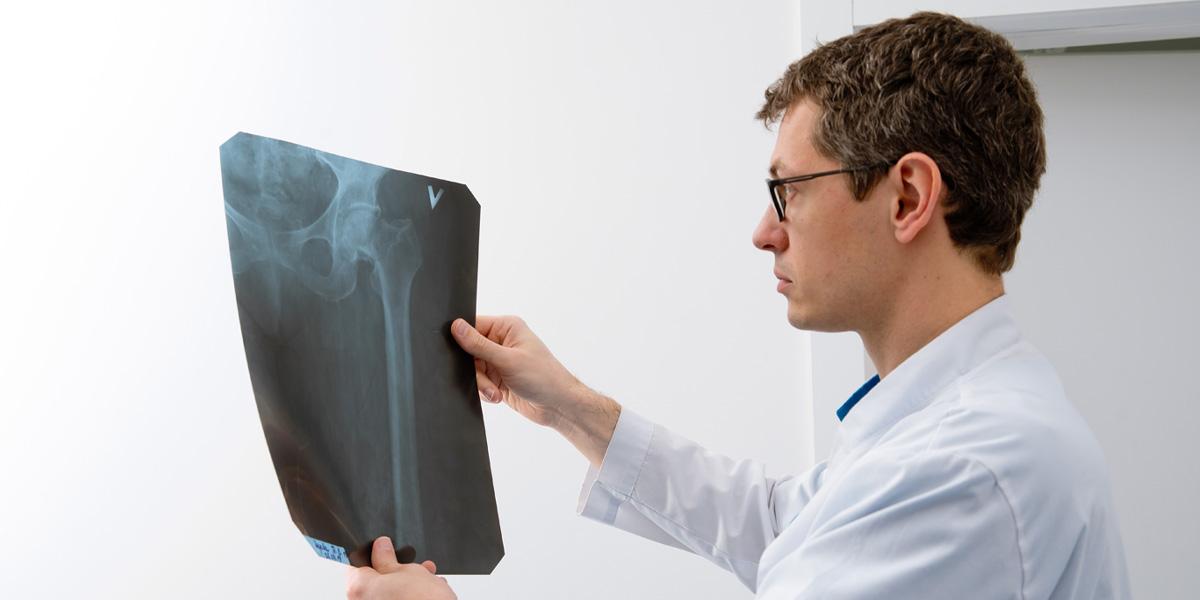 Ендопротезування суглобів: ТОП-5 питань ортопеду